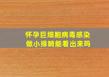 怀孕巨细胞病毒感染 做小排畸能看出来吗